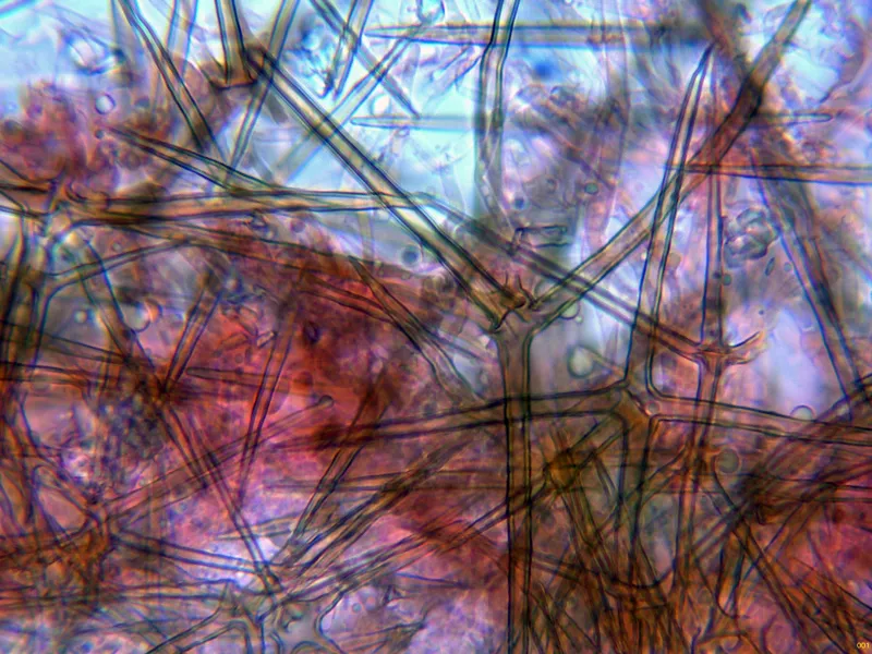 Asterostroma medium 10 - Asterosetas-001